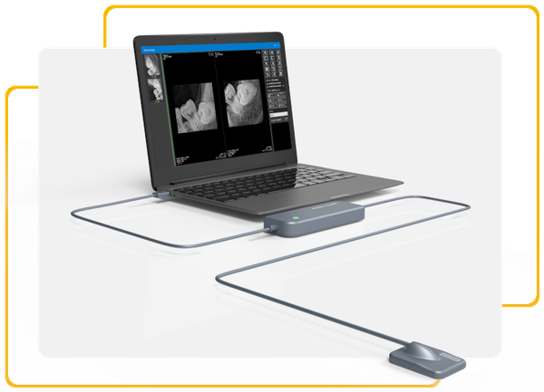 Evolve – RX Sensor