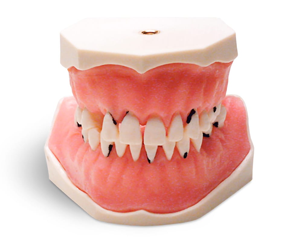 Practice models for periodontology – GF Dental di Ficuciello Antonino, Sonstige Laborgeräte (Waagen, Wasserbäder, Gipsabscheider, Mikroskope)