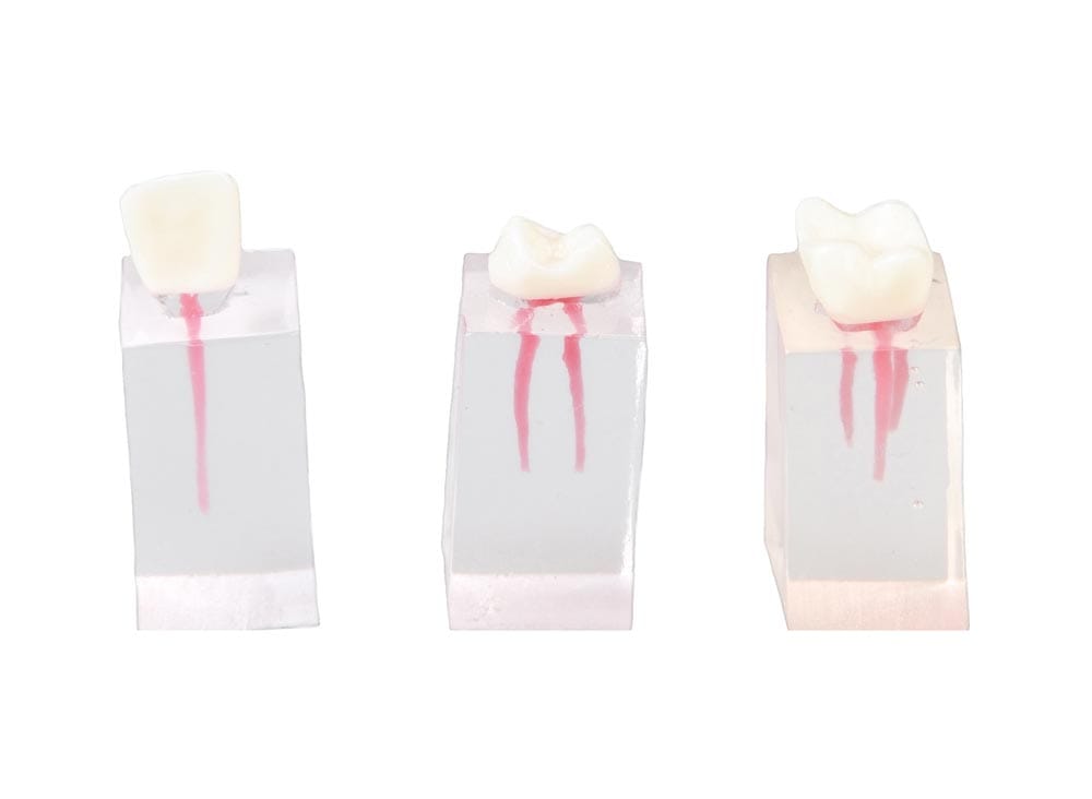 E08/C – Set mit 3 Quadern für einfache endodontische Übungen – GF Dental di Ficuciello Antonino, Demomodelle