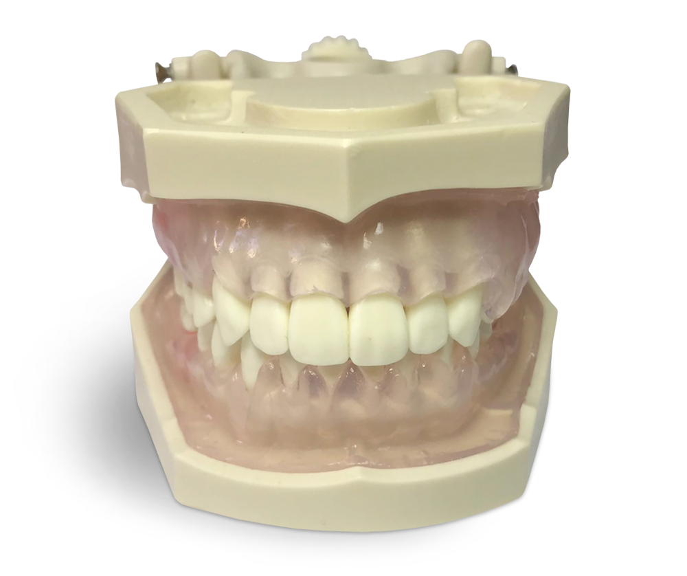 E11/GP – Übungsmodell für Dentalhygienikerinnen – GF Dental di Ficuciello Antonino, Demomodelle