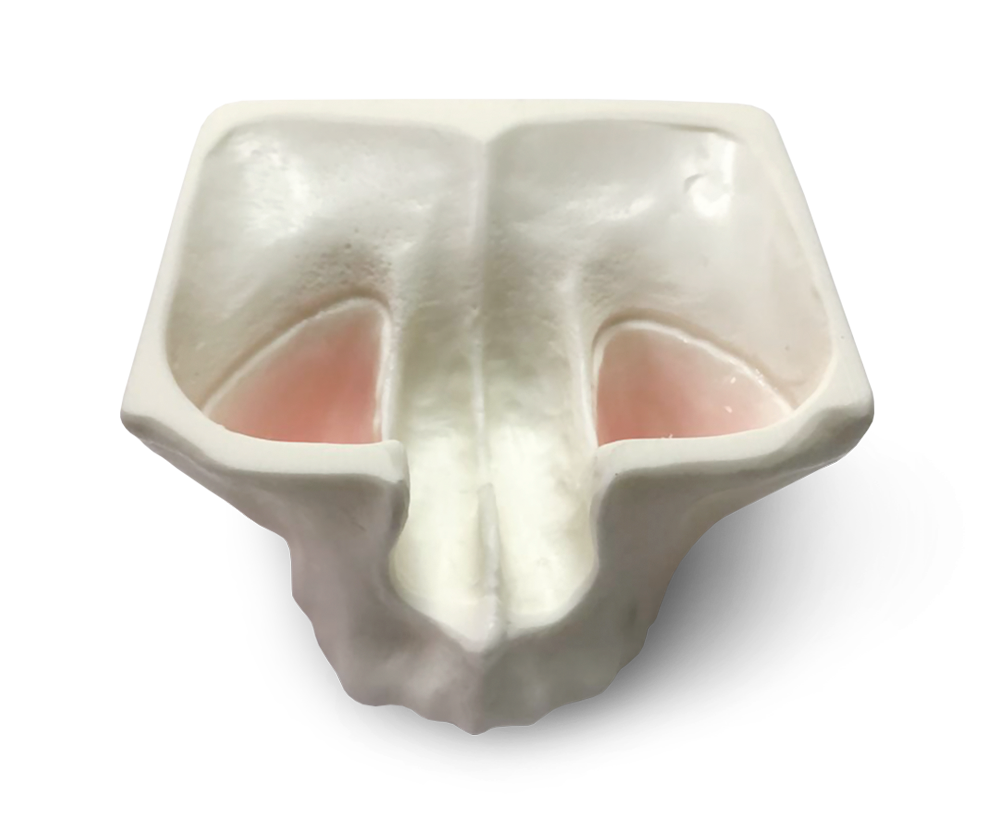 Upper and lower jaw exercise models – GF Dental di Ficuciello Antonino, Wurzelbehandlung