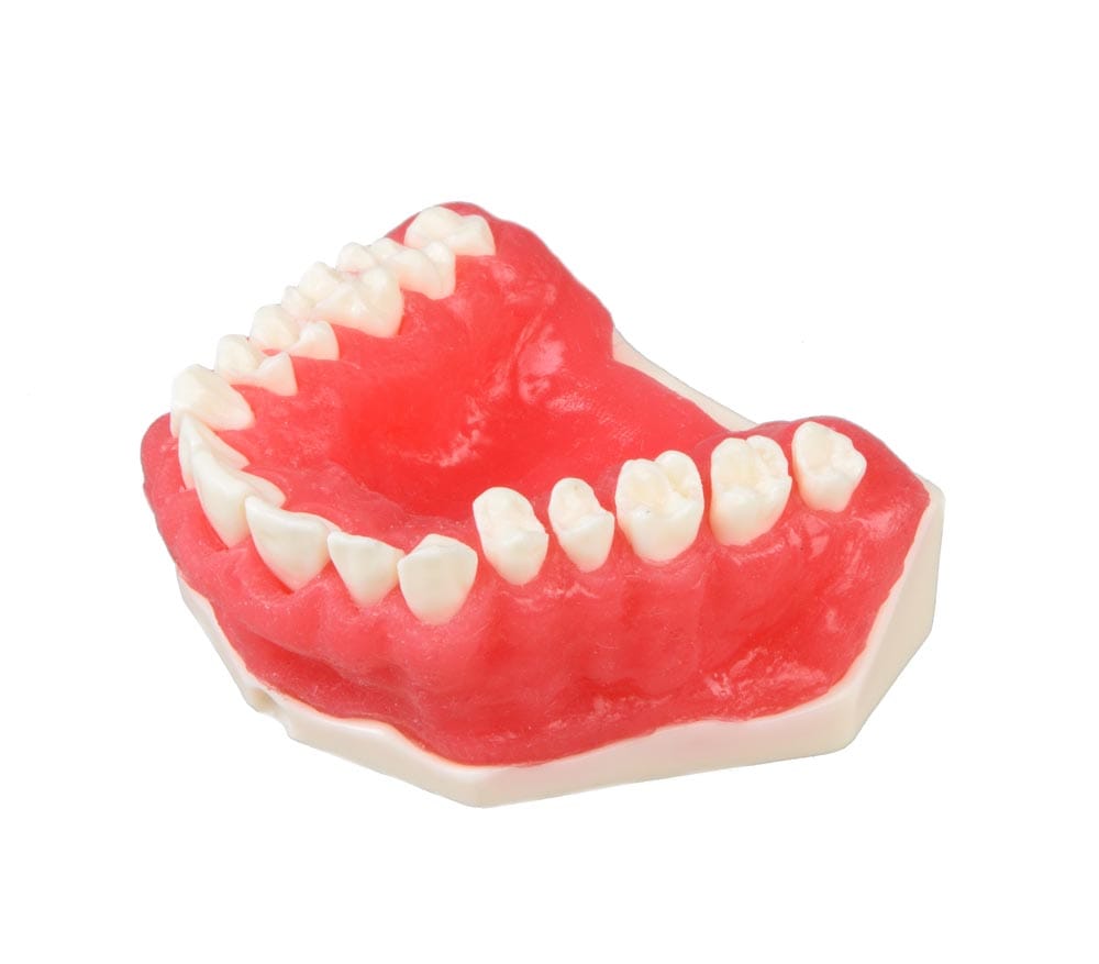 E25 – Oberkiefermodell für Parodontologie – GF Dental di Ficuciello Antonino, Gipszusätze, Stumpflacke und Gipslöser