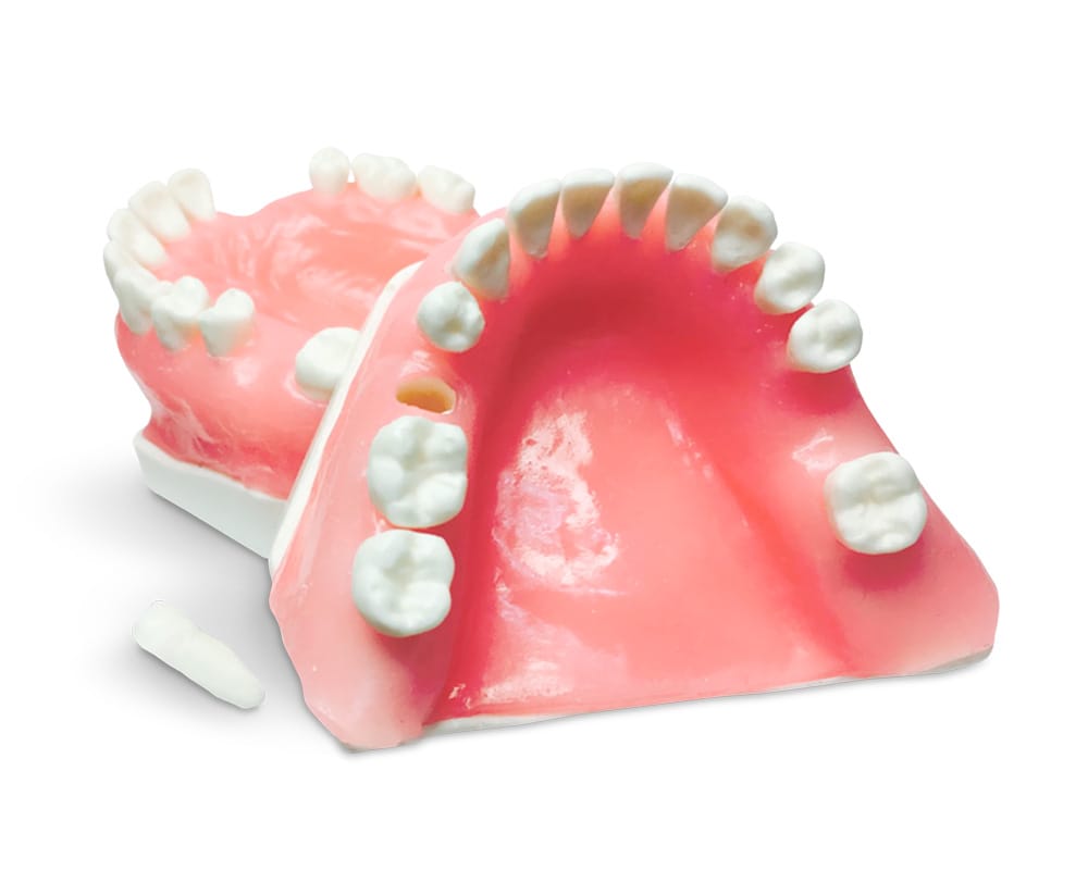 E35 – Übungsmodell für Implantologie nach Extraktion – GF Dental di Ficuciello Antonino, Gipszusätze, Stumpflacke und Gipslöser