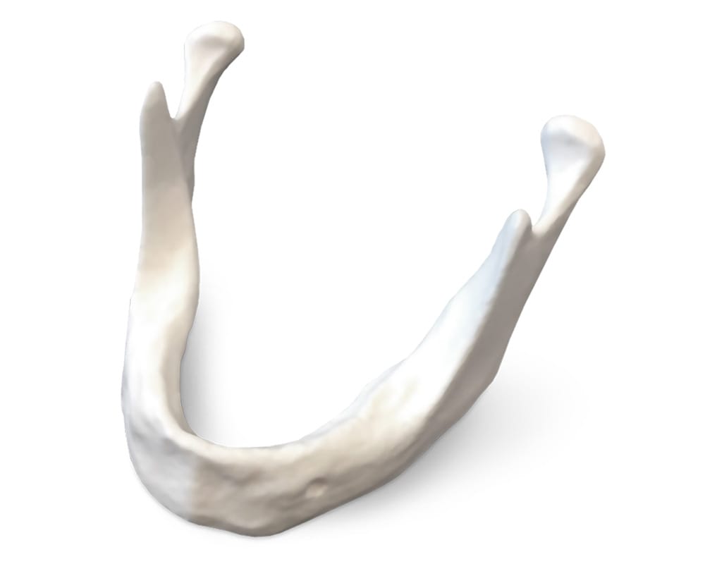 E81 – Unterkiefermodell mit schmalem Alveolarkamm – GF Dental di Ficuciello Antonino, Demomodelle