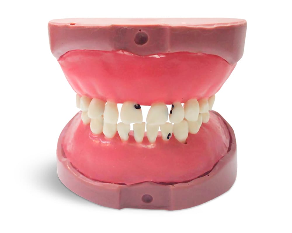 EK5 - Kinderzahnmodell Milchgebiss – GF Dental di Ficuciello Antonino, Demomodelle