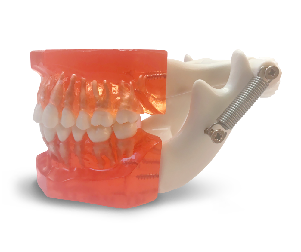 ETR1 – Trainingsmodell für kieferorthopädische Mini-Implantate – GF Dental di Ficuciello Antonino, Miniimplantate