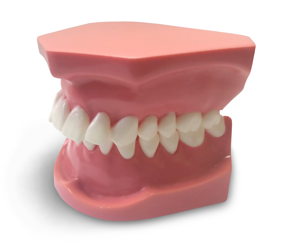 ORB03 – Kieferorthopädisches Modell Klasse 1 Abteilung 2 – GF Dental di Ficuciello Antonino, Demomodelle