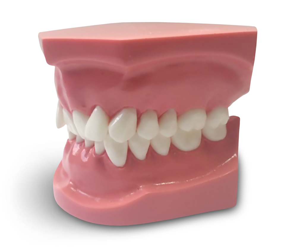ORB06 – Kieferorthopädisches Modell Klasse 2 Abteilung 2 – GF Dental di Ficuciello Antonino, Demomodelle