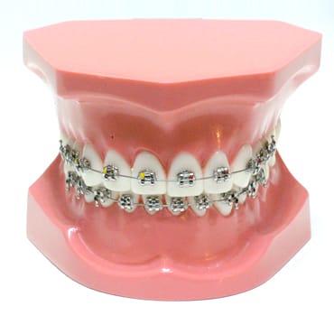 ORB01 – Kieferorthopädisches Modell Klasse 1 – GF Dental di Ficuciello Antonino, Demomodelle