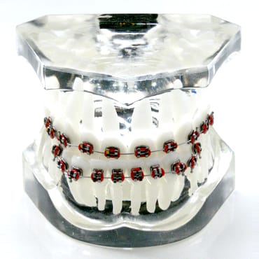 3 class orthodontic model – GF Dental di Ficuciello Antonino, Gipszusätze, Stumpflacke und Gipslöser