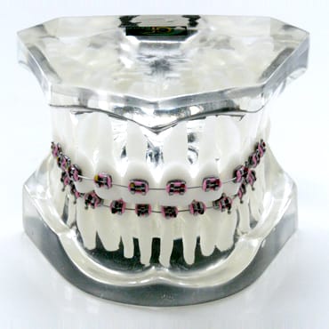 Transparent Dental Models – GF Dental di Ficuciello Antonino, Sonstiges KFO