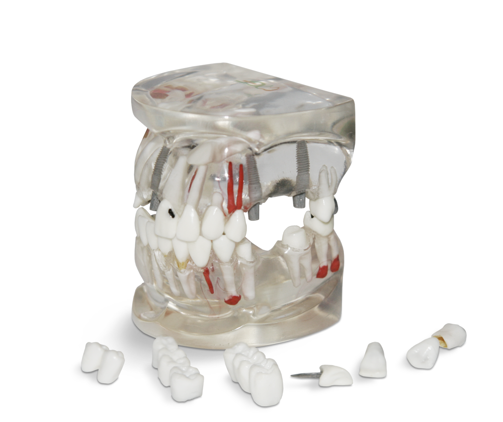 Patient doctor dialog model – GF Dental di Ficuciello Antonino, Gipszusätze, Stumpflacke und Gipslöser