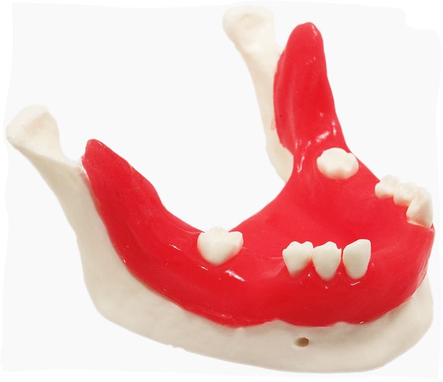 E21/T – Unterkiefermodell für implantologisches Training – GF Dental di Ficuciello Antonino, Gipszusätze, Stumpflacke und Gipslöser