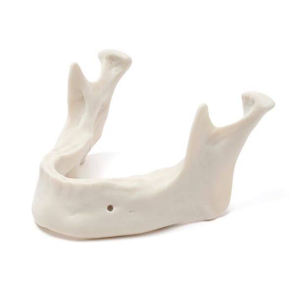 MANDIBULA A1 BONE