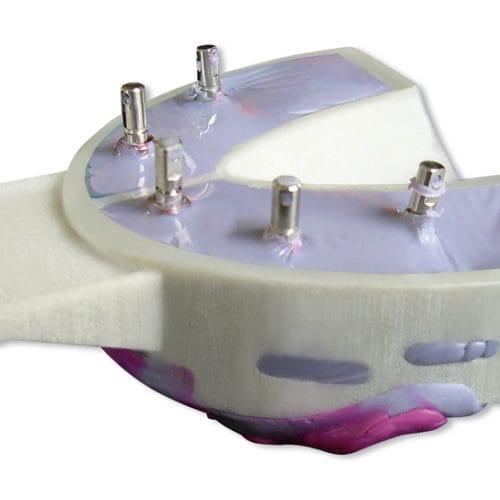 Miratray® Implant – Hager Werken, Abdrucklöffel