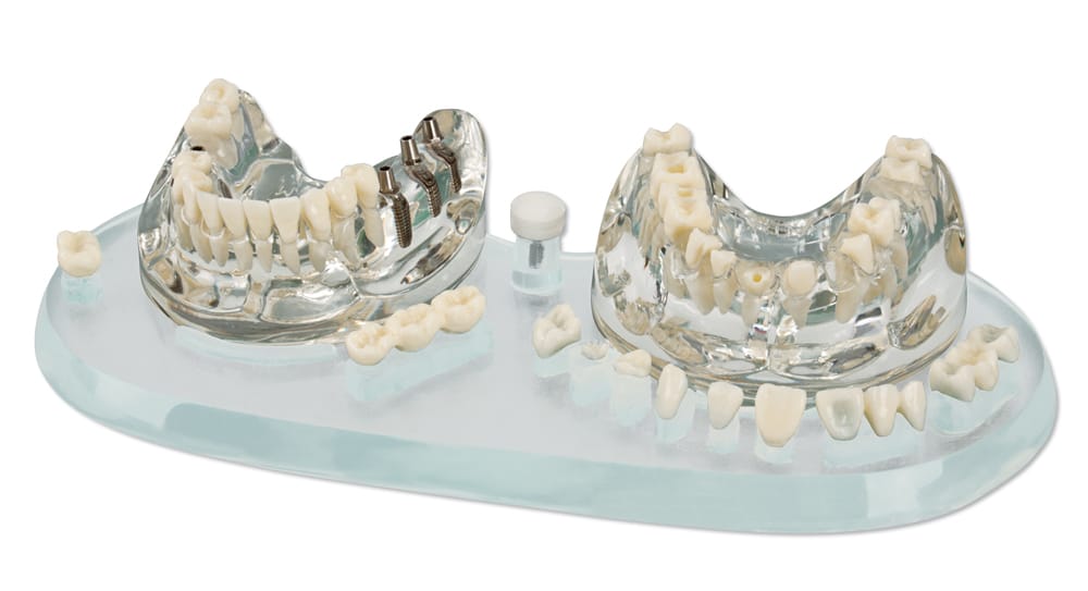 Studienmodell Demo Implant C+B – Hager Werken, Demomodelle