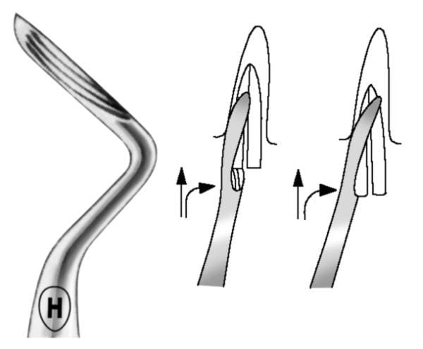 HSA 723-06, Wurzelheber – Karl Hammacher, Wurzelheber