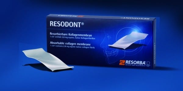 RD2502 S Resodont – Karl Hammacher, Membranen