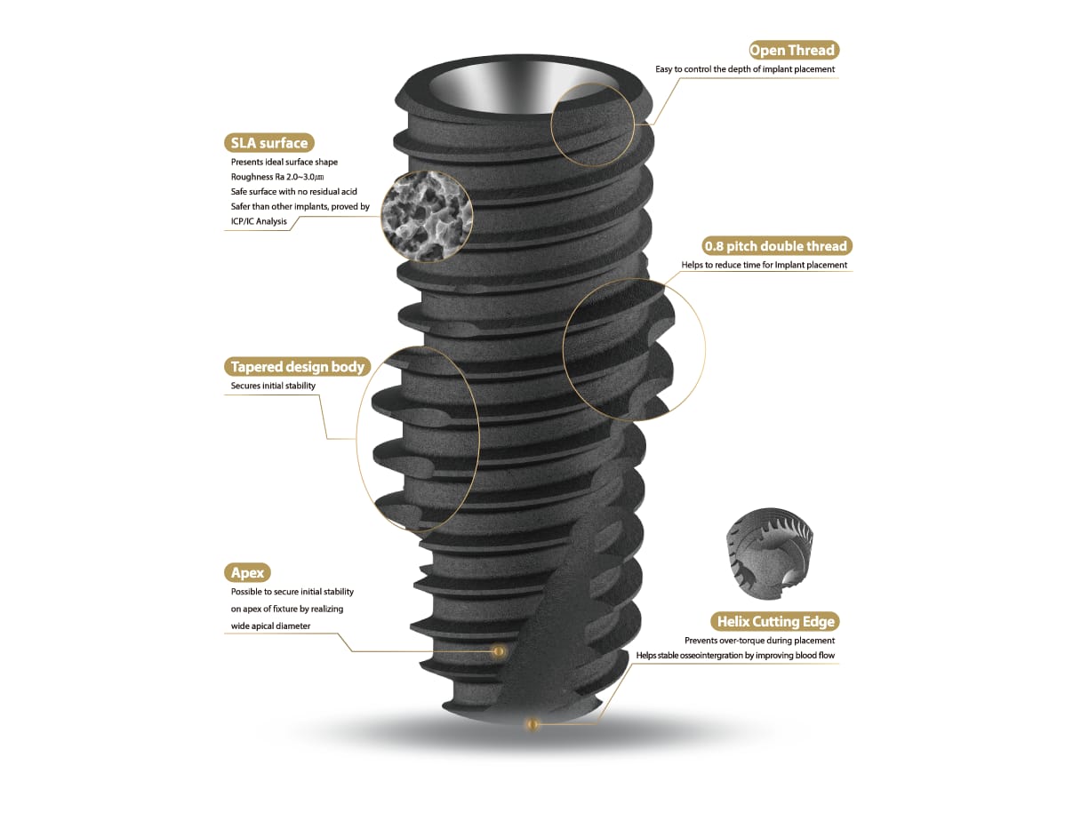 R-System – IZEN IMPLANT CO., LTD., Implantate