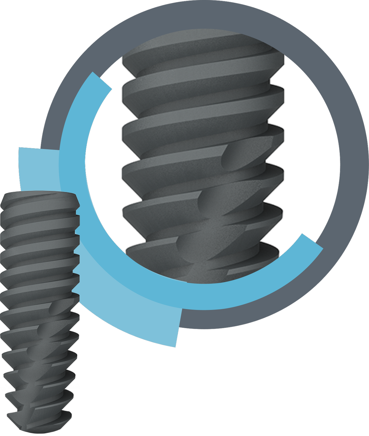 S-Fix – Kamal Encon Industries Ltd, Implantate