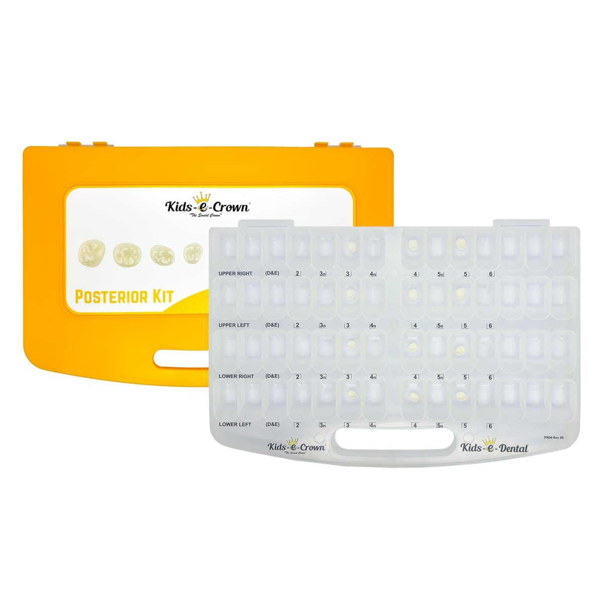 Erster Molar Trial-Kit – Kids-e-Dental LLP, Provisorische Kronen
