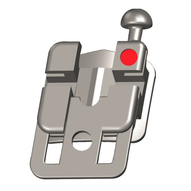 Selbstligierendes kieferorthopädisches Metallbracket – Modern Orthodontics, Brackets
