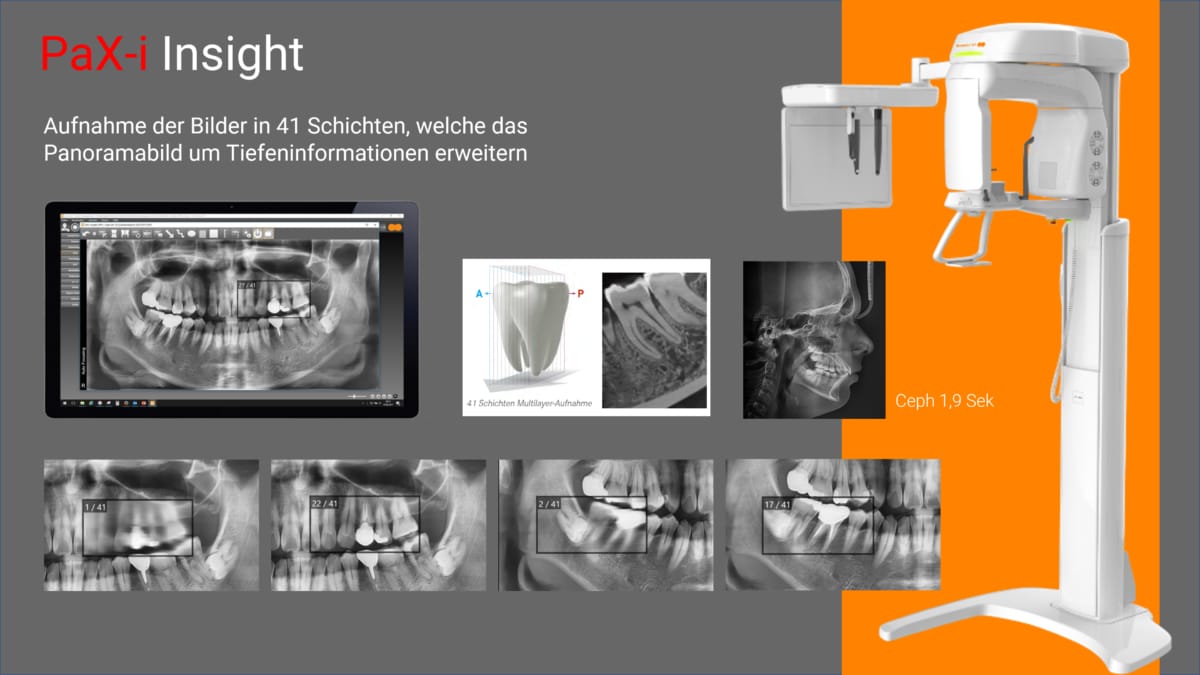 PaX-i Insight FSC – orangedental, Röntgen