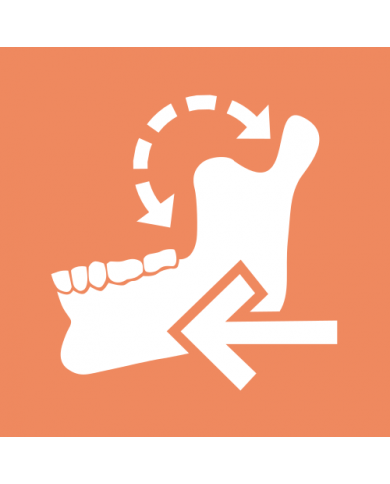 Jaw Motion Import – Zyrkon Medical, S.L., CAD/CAM-Software