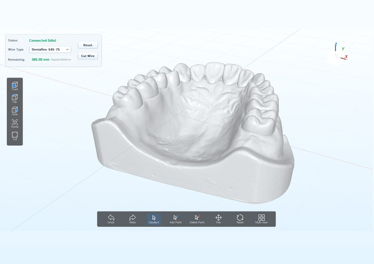 WBM-T1 – Guangzhou Riton Additive Technology Co.,Ltd, Orthodontische Spezialkleber