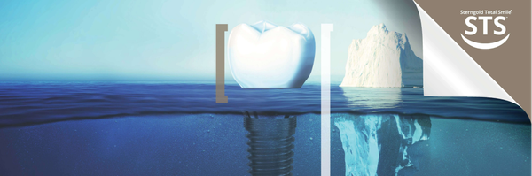 STS1: Implantatgetragene digitale Totalprothesen
