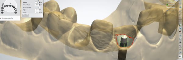 Stern SNAP Attachment System