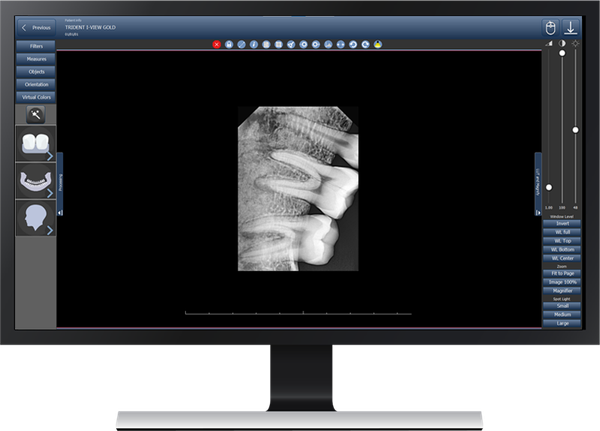 Software de imágenes dentales