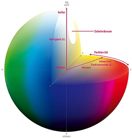 VITA classical A1–D4 – VITA Zahnfabrik H. Rauter, Diagnostik