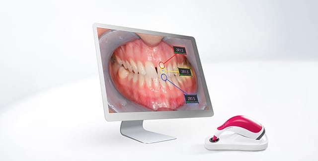 VITA Assist – VITA Zahnfabrik H. Rauter, CAD/CAM-Software