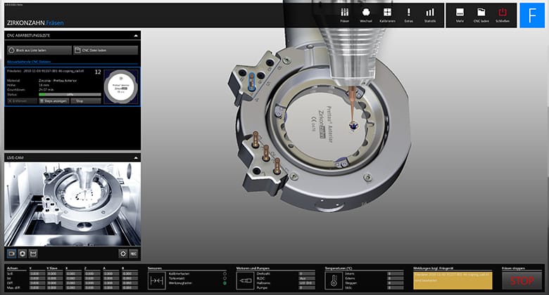 Zirkonzahn.Fräsen – Zirkonzahn, CAD/CAM-Software
