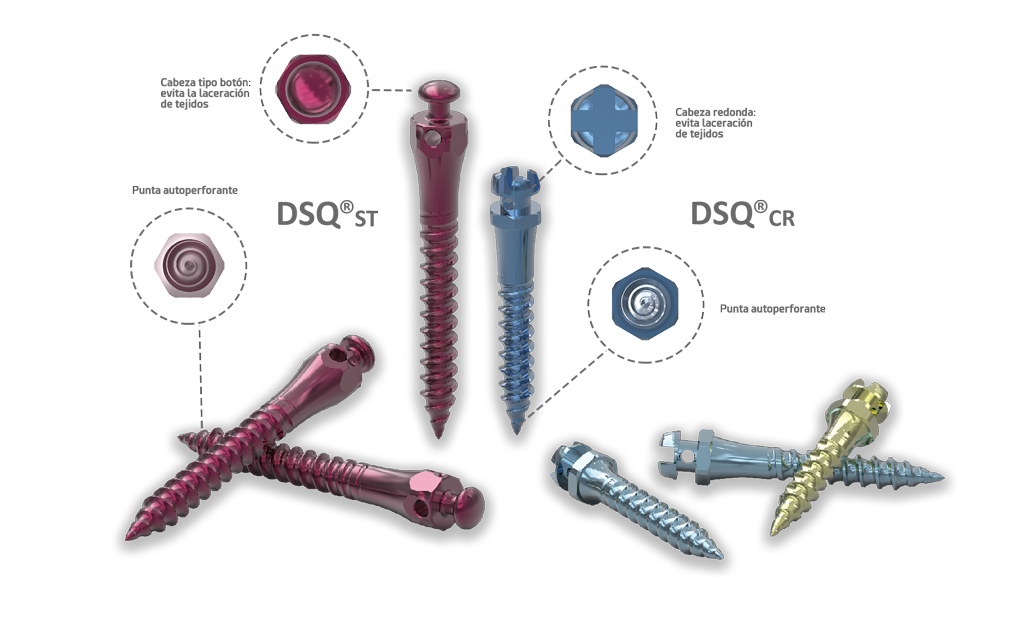Los microimplantes DSQ para tratamientos de ortodoncia – Ziacom Medical S.L.U, Verankerungssysteme